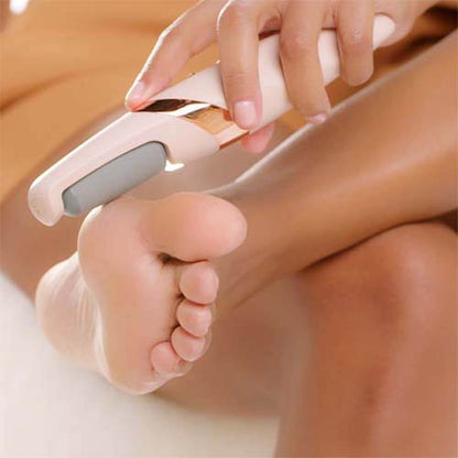 Callus Remover – Say Goodbye to Rough, Dry Skin!