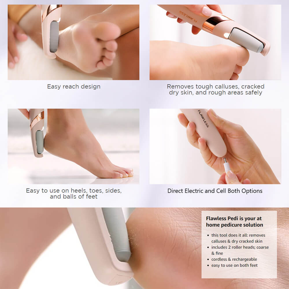 Callus Remover – Say Goodbye to Rough, Dry Skin!