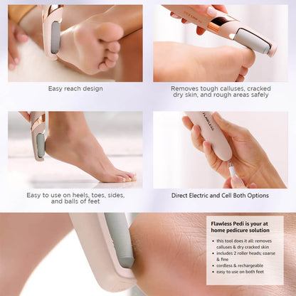 Callus Remover – Say Goodbye to Rough, Dry Skin!